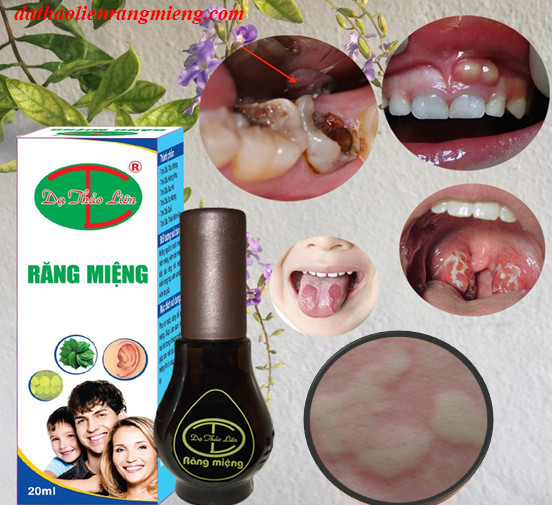 răng miệng dạ thảo liên chính hãng tại Hà Nội