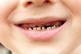 Răng miệng dạ thảo liên tại an giang