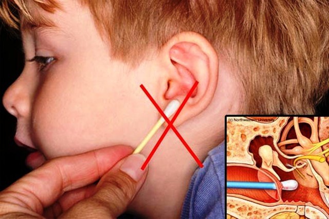 Trị nấm tai hiệu quả với răng miệng dạ thảo liên