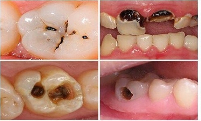 răng miệng dạ thảo liên 20ml tại hà nội